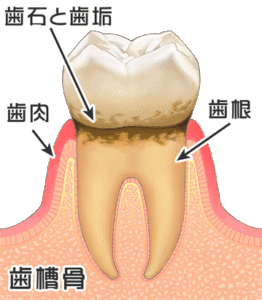 Dental Periodontal