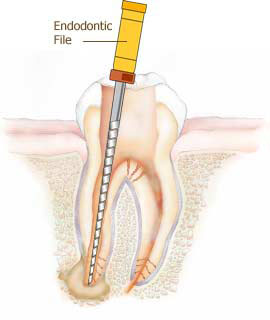 Dental Root